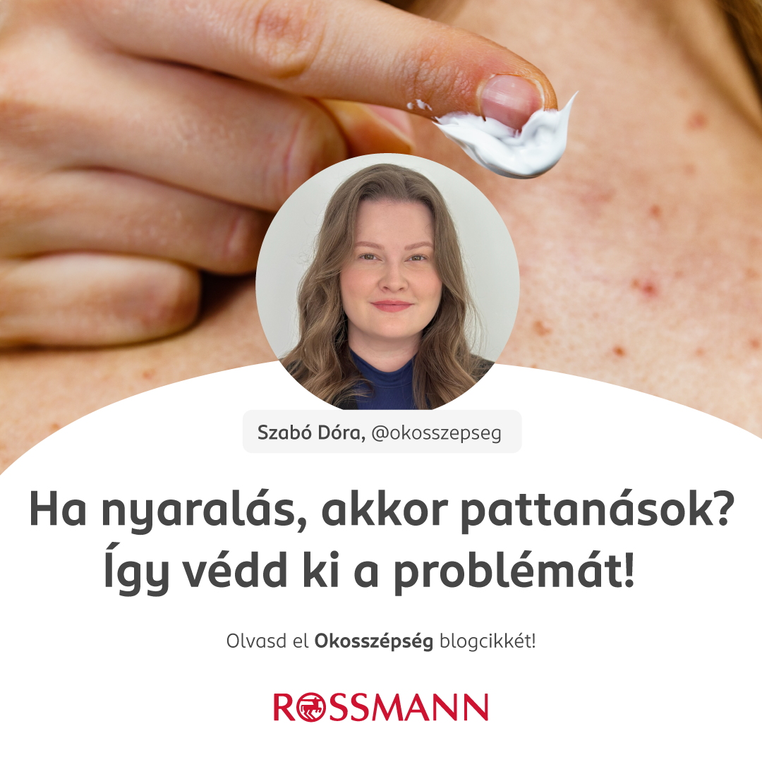 Ha nyaralás, akkor pattanások? Így védd ki a problémát! kép