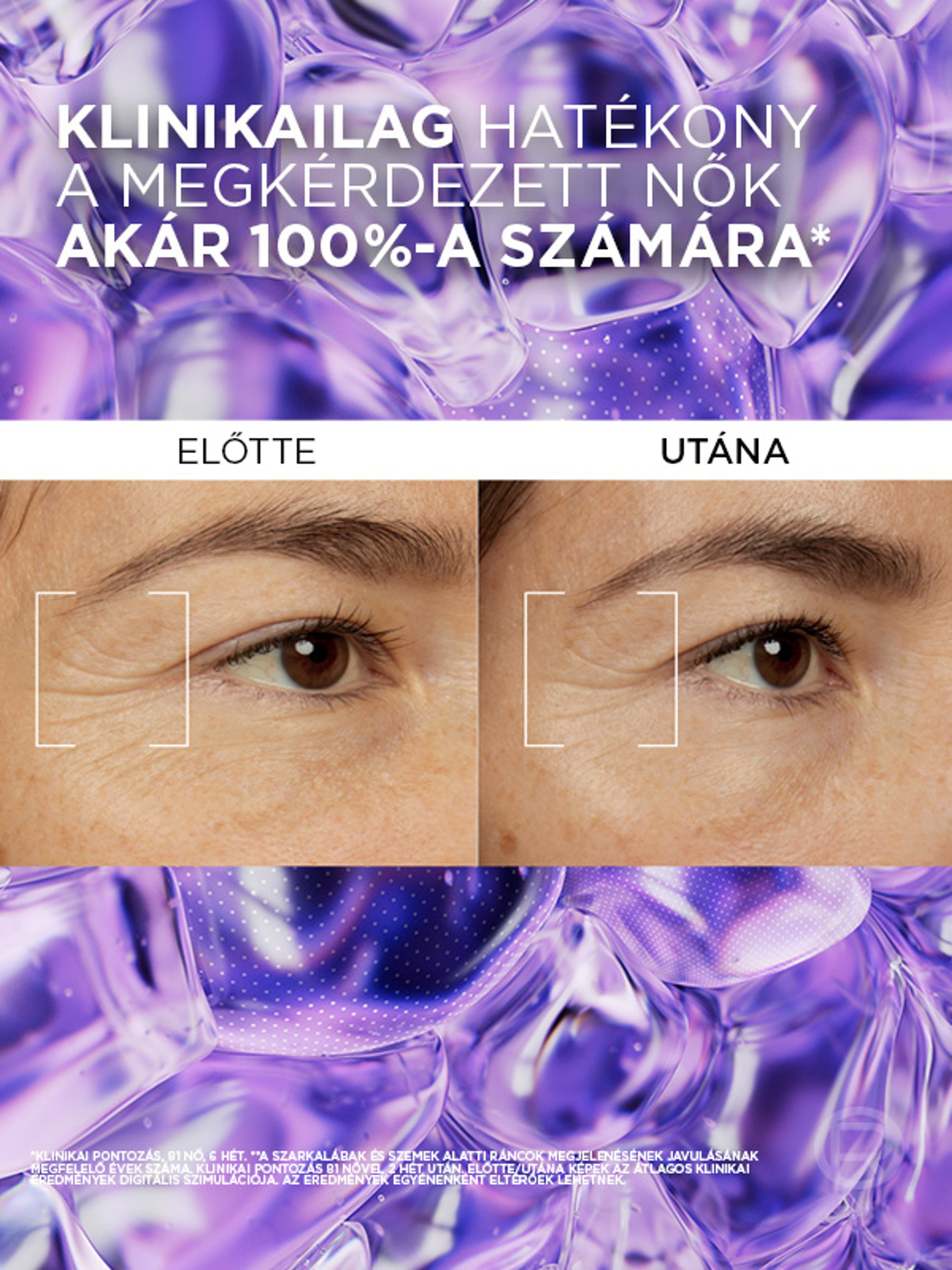 L'Oréal Paris Revitalift Filler szemkörnyék szérum 2,5% hialuronsavval - 20 ml-7