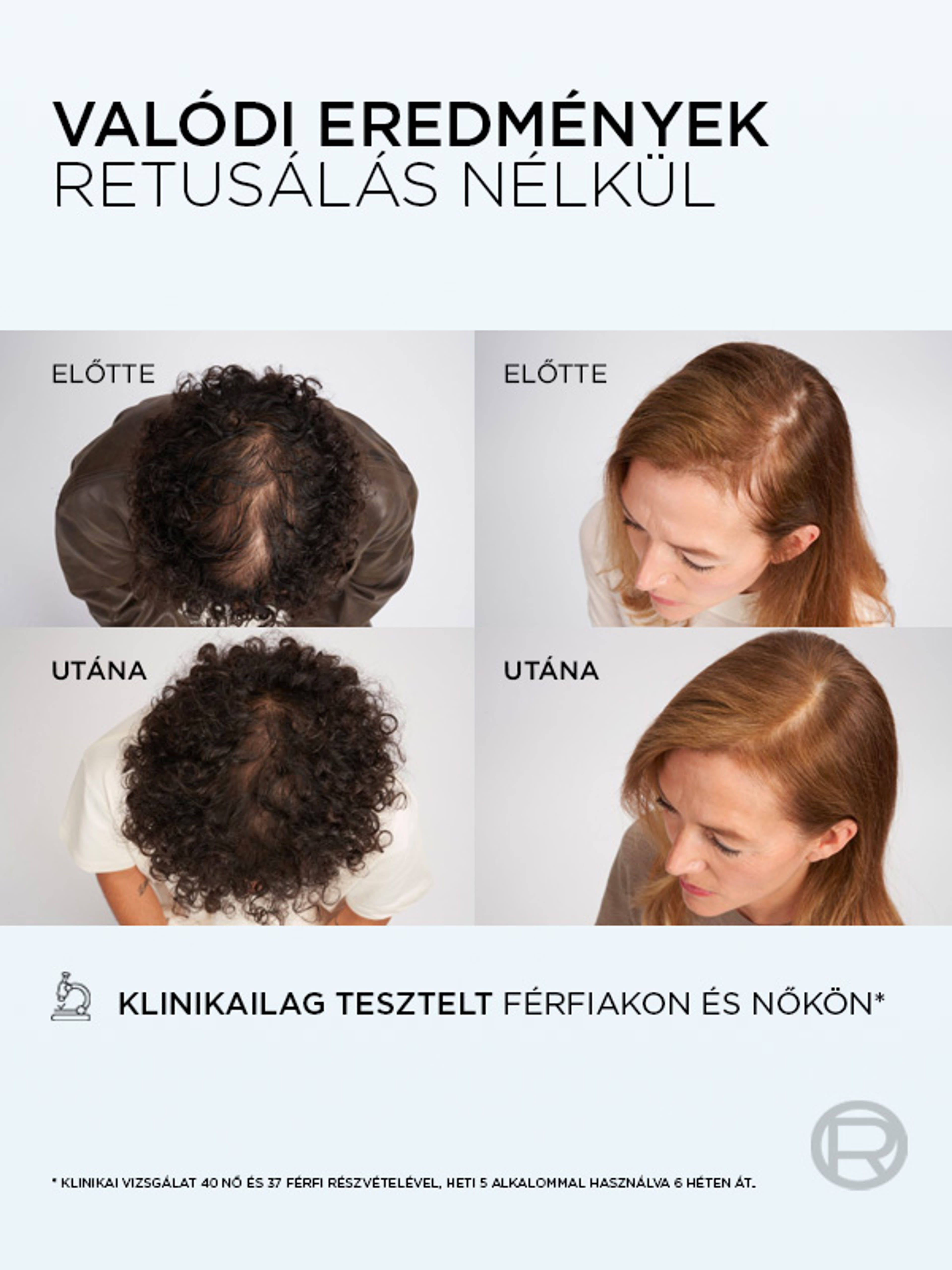L'Oréal Paris Elseve Growth Booster hajhullás elleni szérum - 102 ml-4