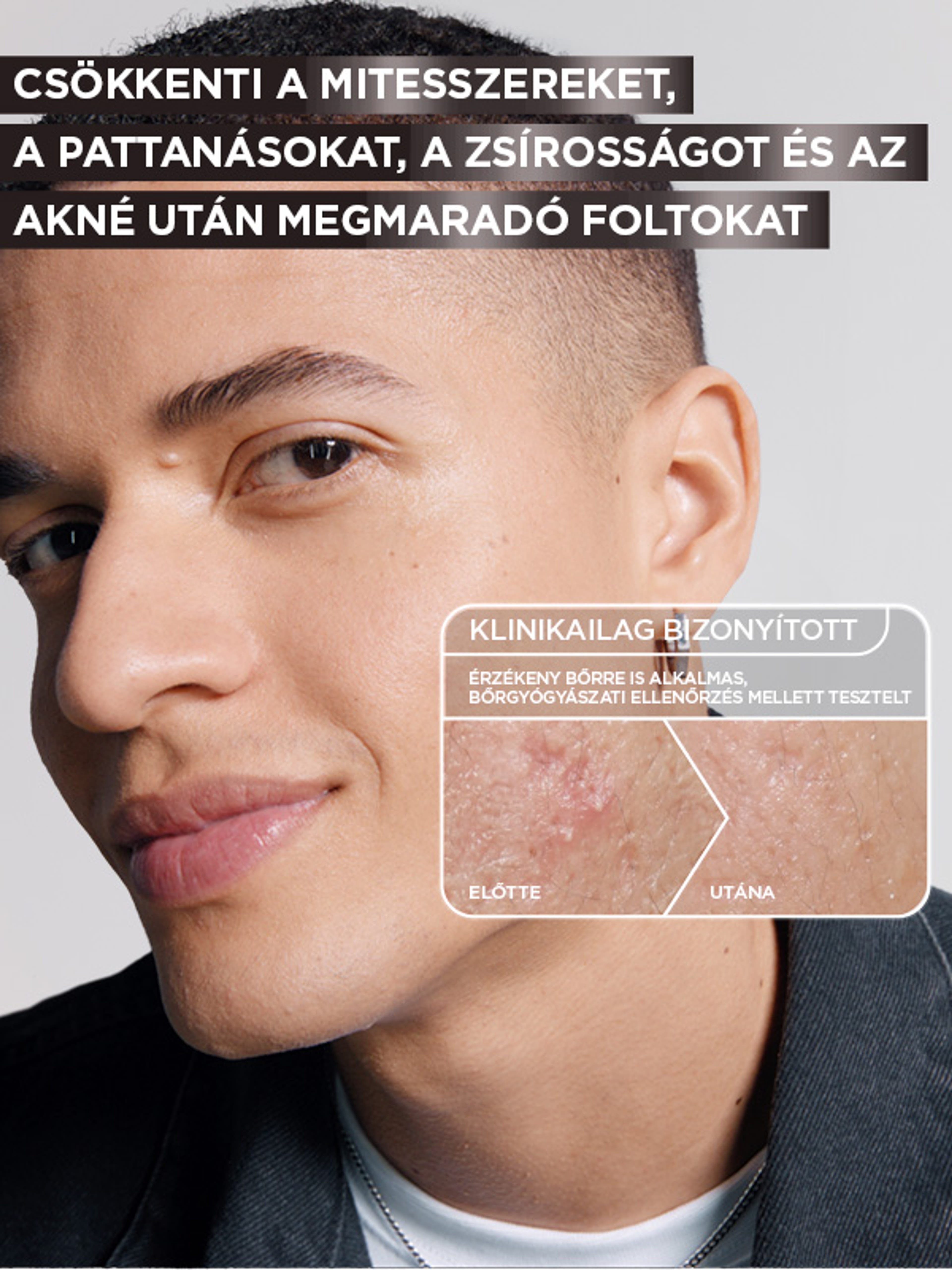 Garnier Pure Active bőrhibák elleni szérum AHA + BHA aktív szén - 30 ml-8