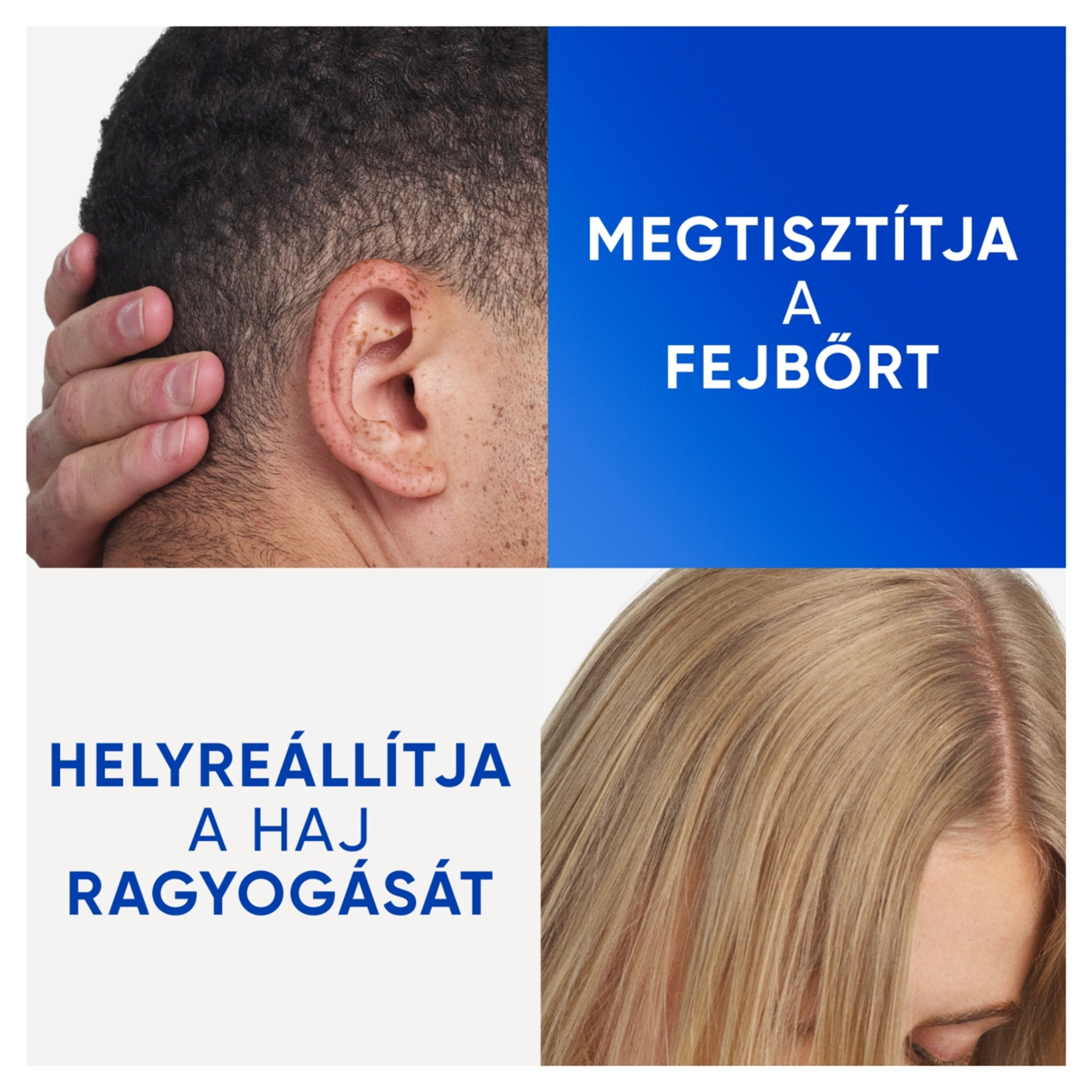 Head & Shoulders Clarify & Shine korpásodás elleni sampon - 400 ml-8