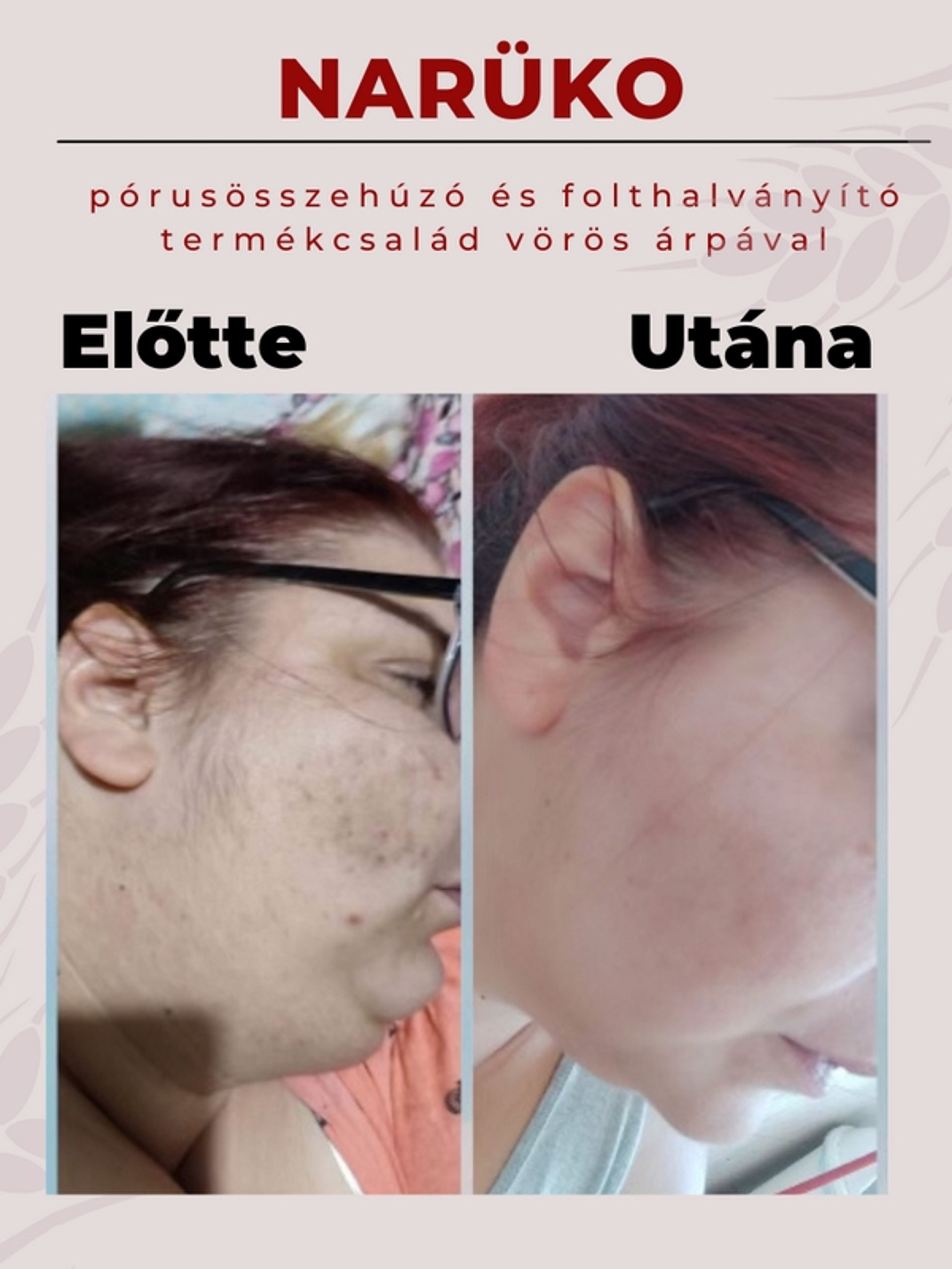 Narüko pórusösszehúzó és folthalványító fátyolmaszk vörös árpával - 25 ml-5