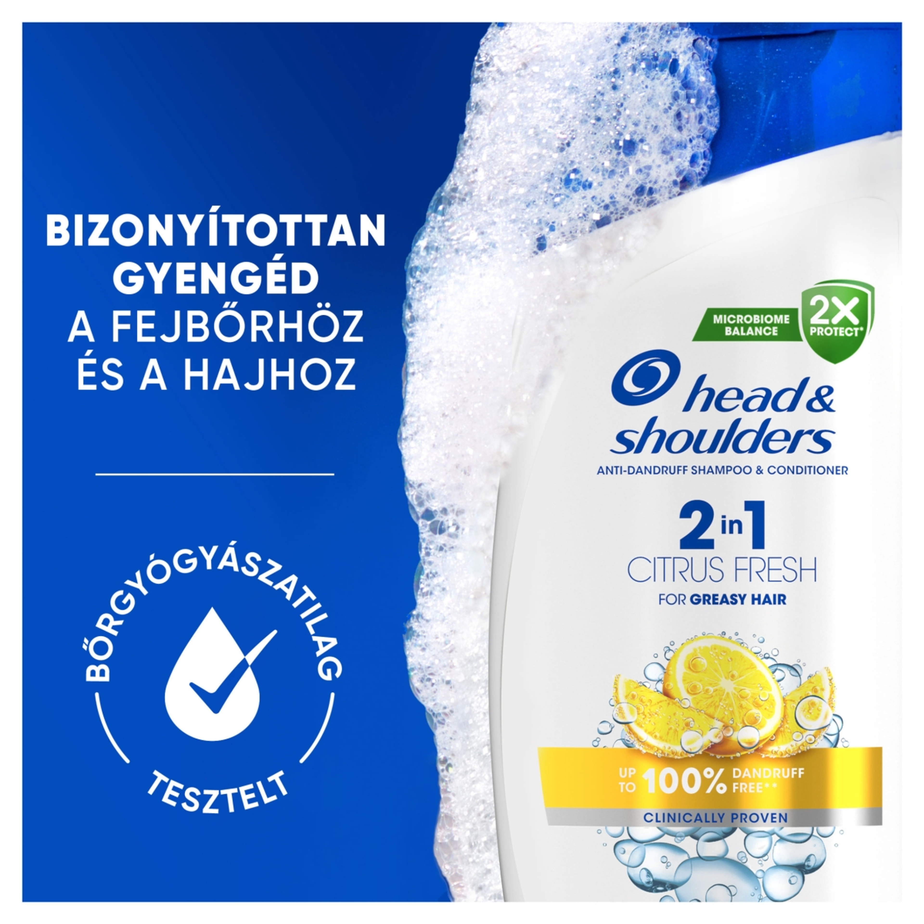 Head & Shoulders Citrus Fresh 2 az 1-ben korpásodás elleni sampon zsíros hajra - 330 ml-6
