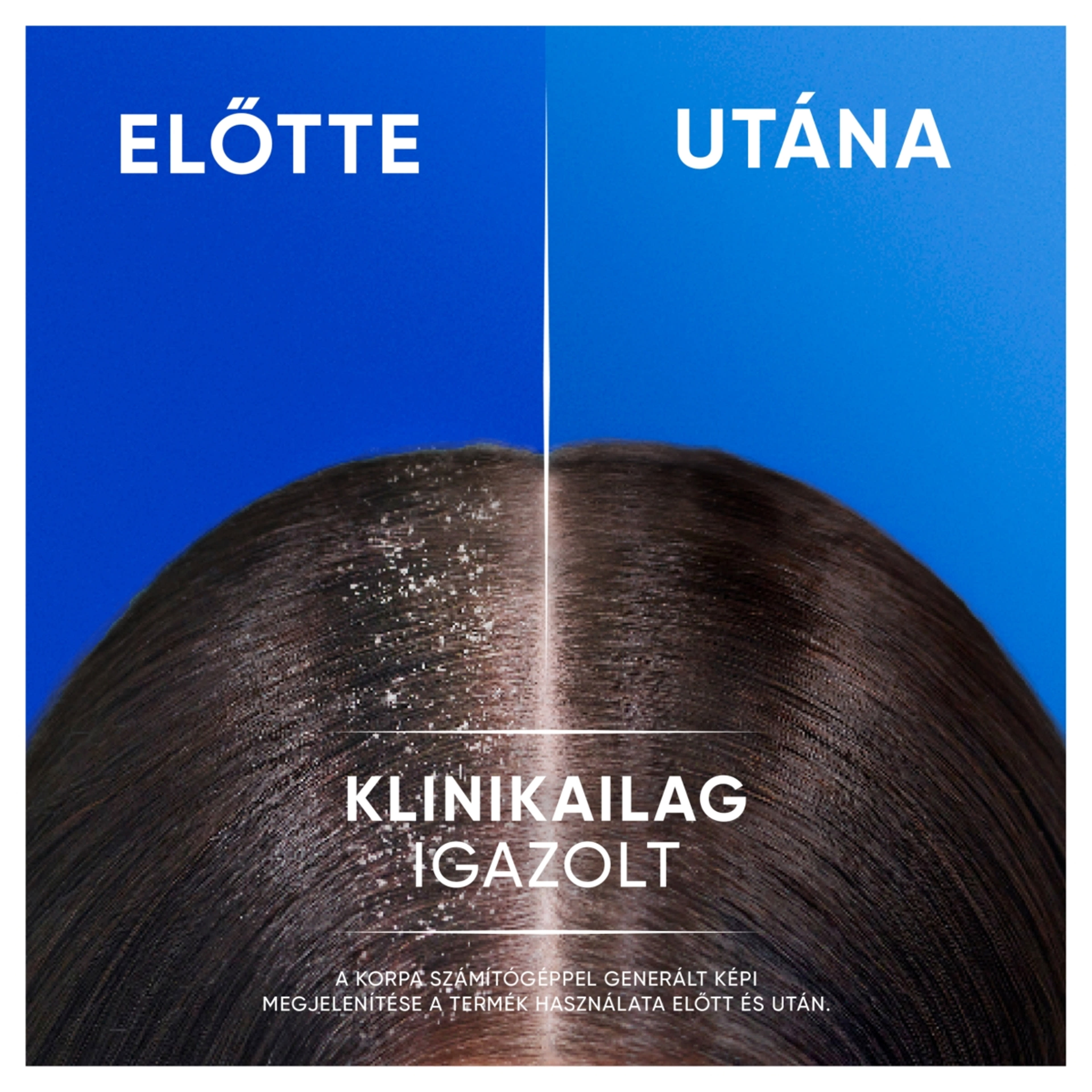 Head & Shoulders Classic Clean 2 az 1-ben korpásodás elleni sampon - 330 ml-3