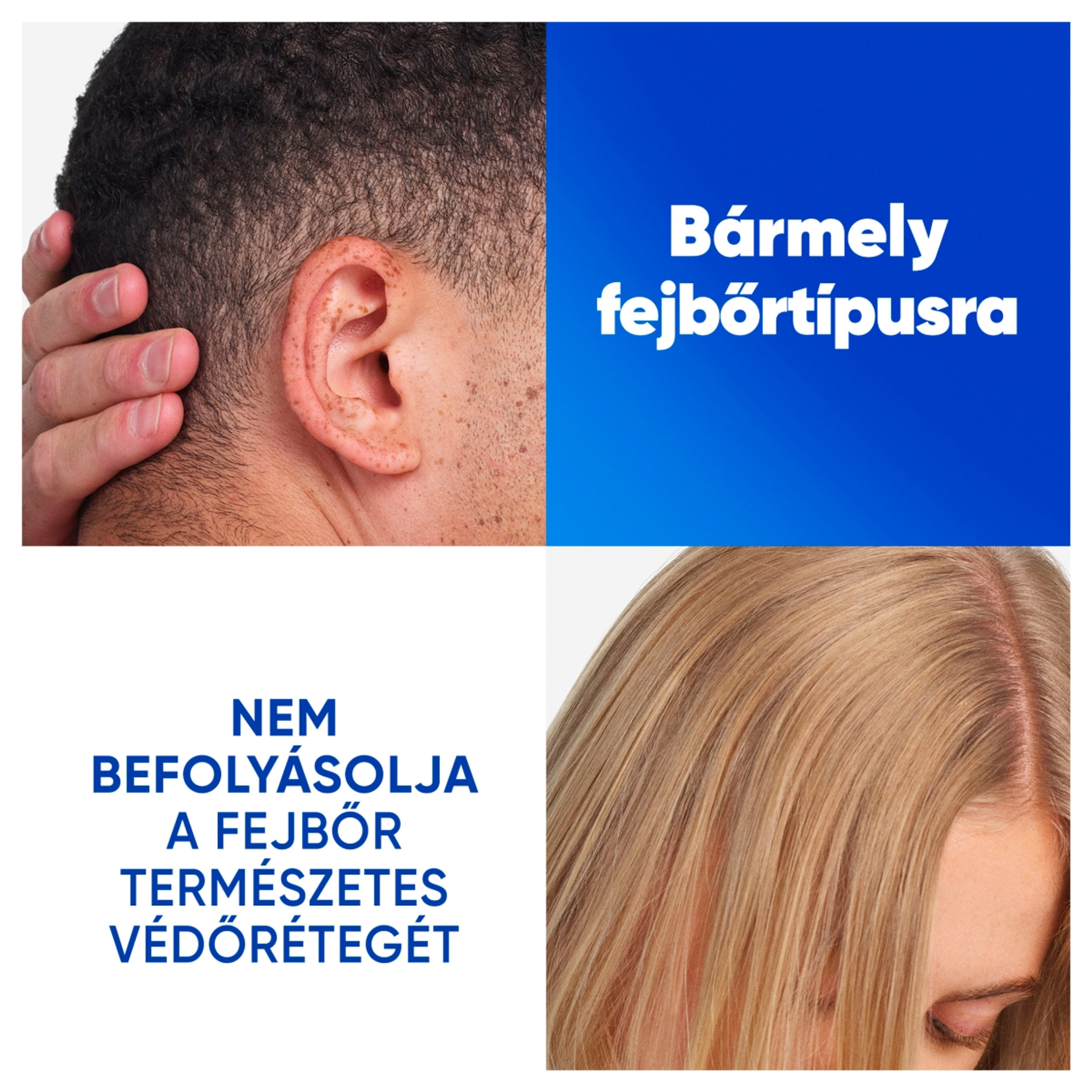 Head & Shoulders Menthol Korpáspdás Elleni sampon - 400 ml-4
