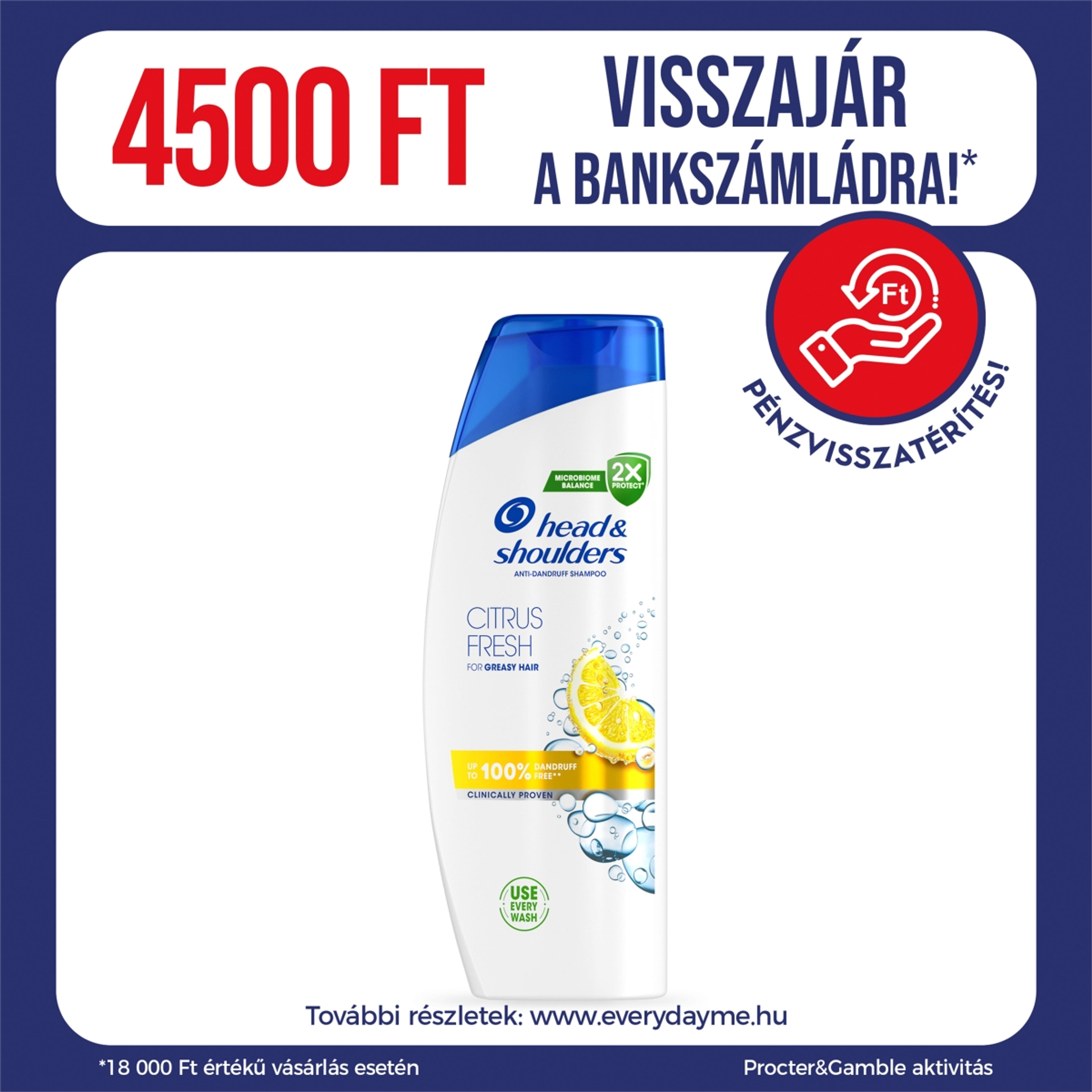 Head & Shoulders Citrus Fresh Korpásodás Elleni sampon - 400 ml