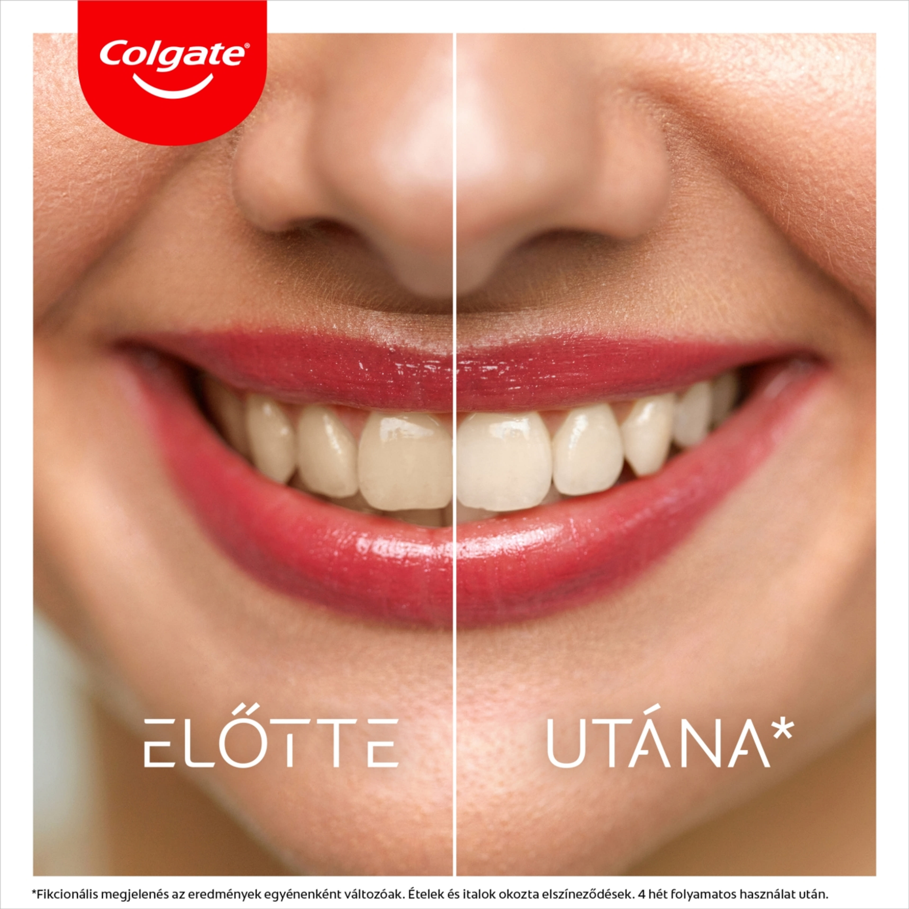 Colgate Max White Ultra Multiprotect fogfehérítő fogkrém - 50 ml-8