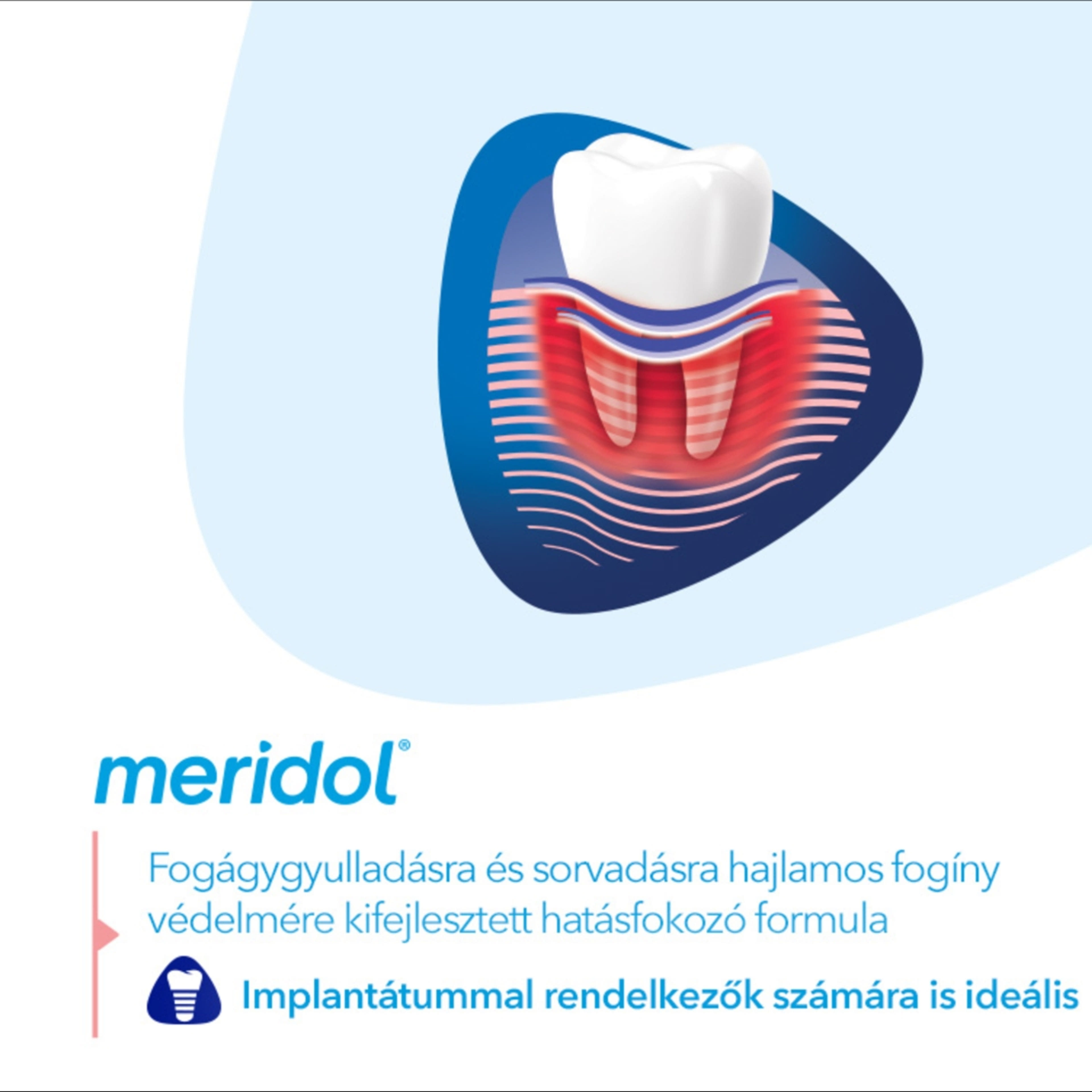 Meridol Paradont Expect fogkrém - 75 ml-4
