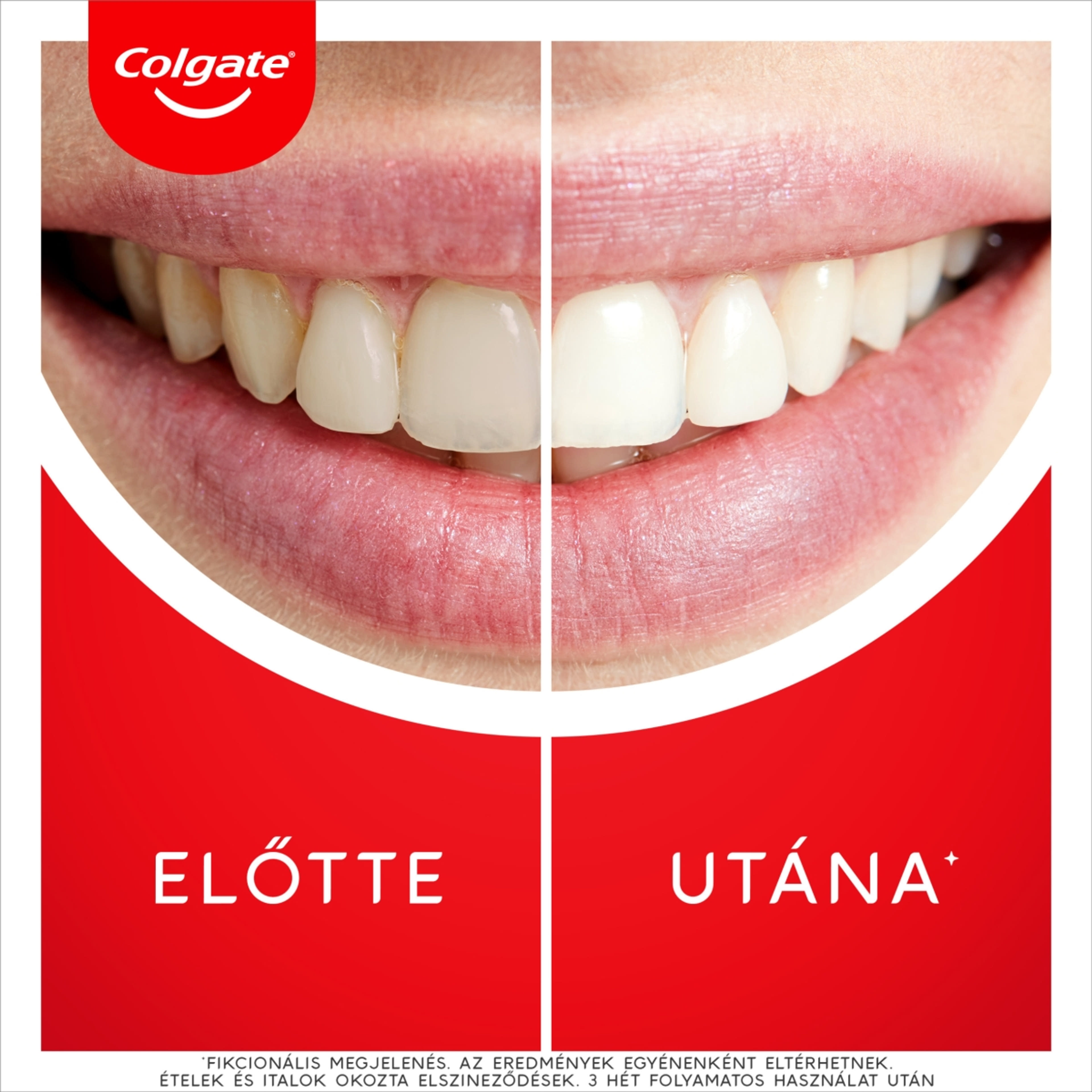 Colgate Max White Ultra Freshness Pearls fehérítő fogkrém - 50 ml-5