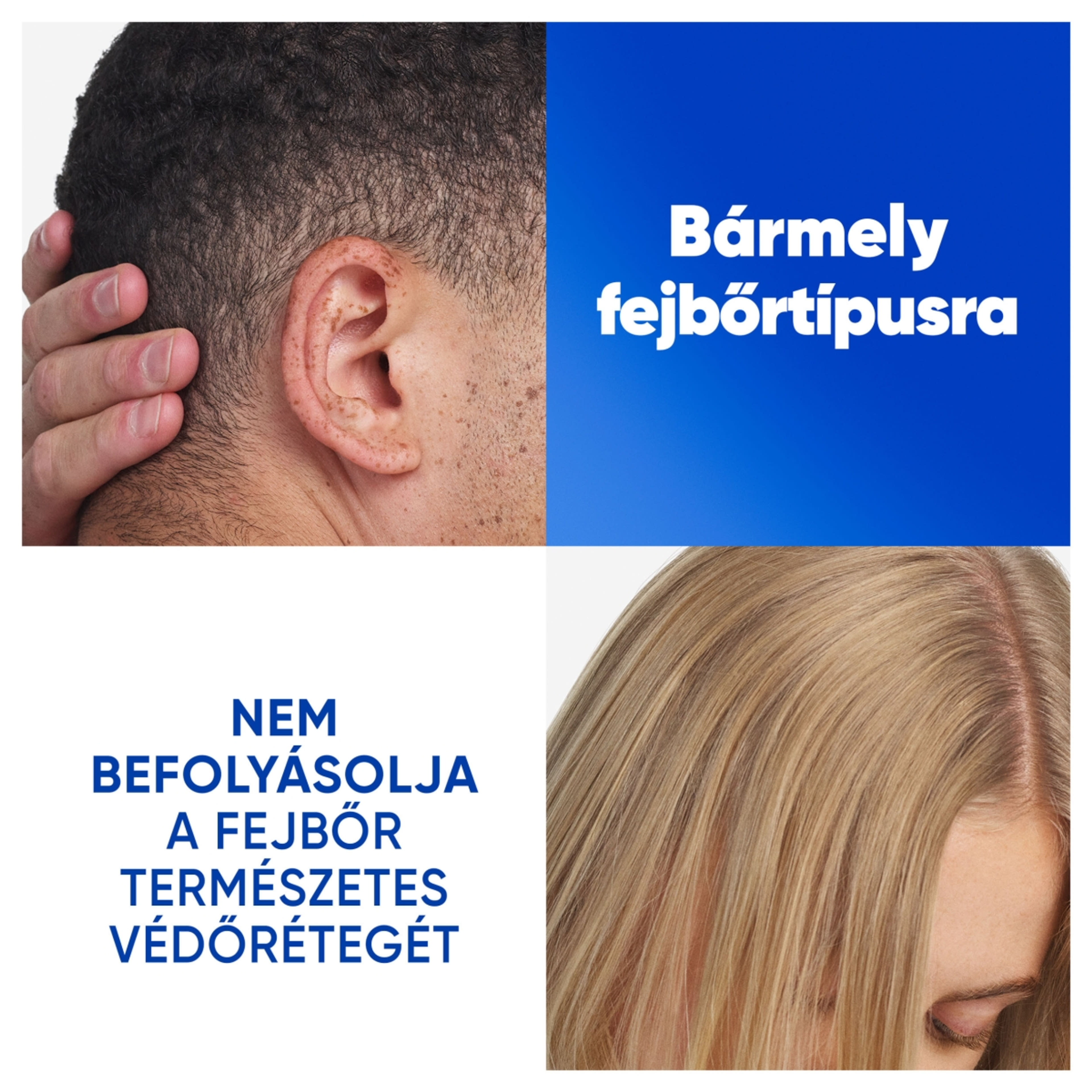 Head & Shoulders Citrus Fresh korpásodás elleni sampon zsíros hajra - 250 ml-4