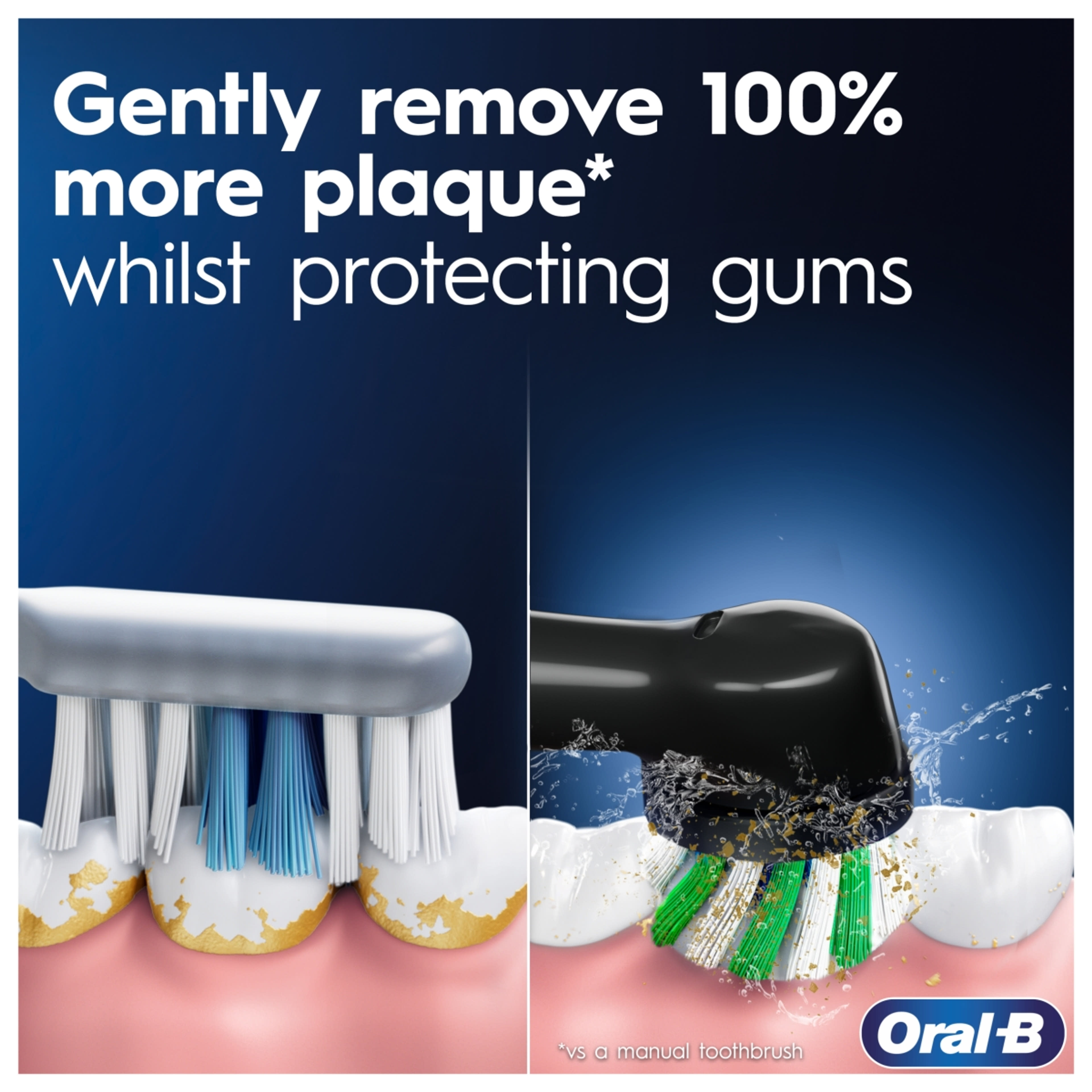 Oral-B Pro Series 1 elektromos fogkefe, kék - 1 db-5